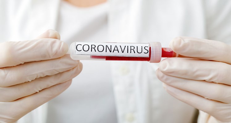 Corona-test_cb_1128x600.jpg