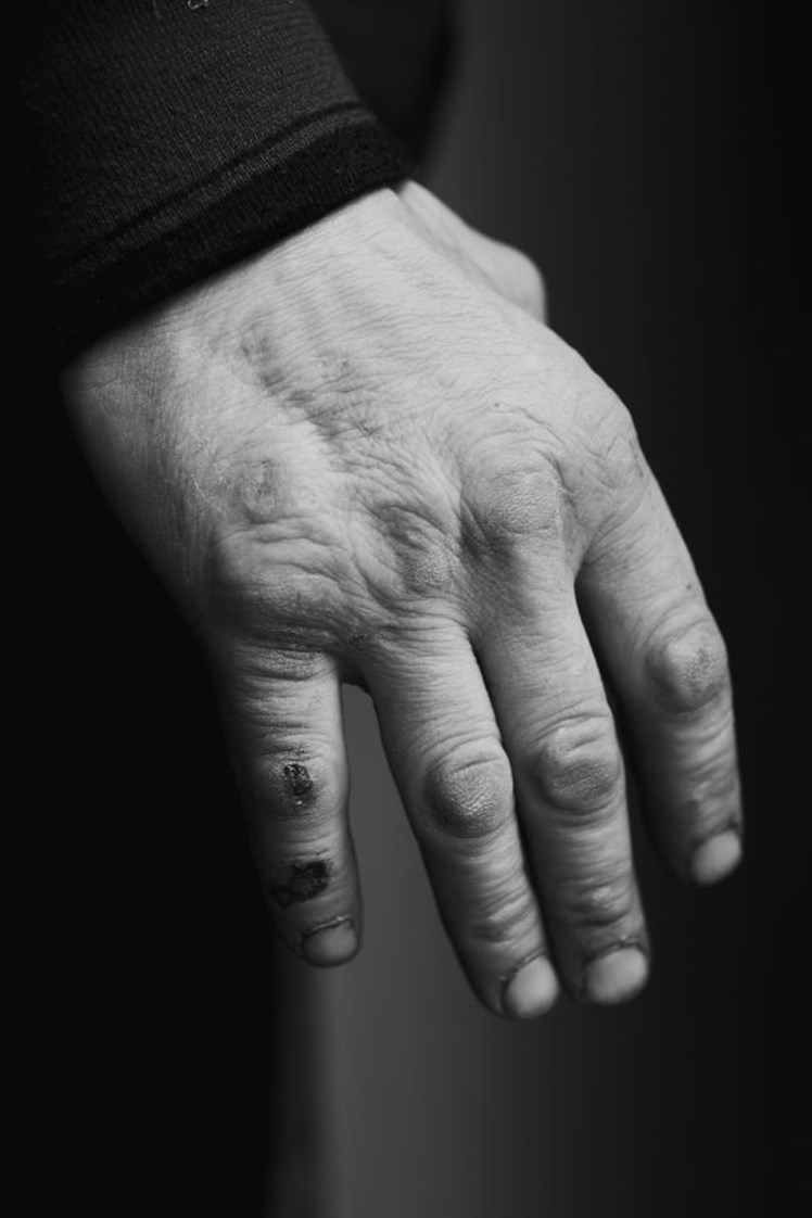 Når vinterkulden rammer, oplever brugerne både udfordringer med at holde varmen og få førlighed i fingrene, men også med at finde årerne. – Men vi har en masse strikkekoner, som strikker handsker, huer og strømper til os i lange baner, ligesom vi ofte får doneret lange underbukser, liggeunderlag og soveposer, fortæller Michele Andersen.